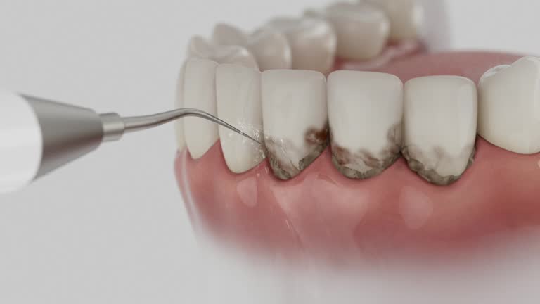 Trusted Wisdom Tooth Removal service in Wesson, MS - Dentist Open Now